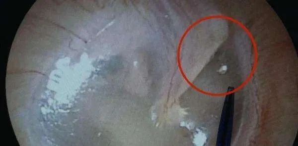 小姐姐亲猫，脸上竟长了「脚气」！养宠这些卫生问题千万别忽略(图8)