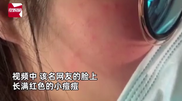 小姐姐亲猫，脸上竟长了「脚气」！养宠这些卫生问题千万别忽略(图1)
